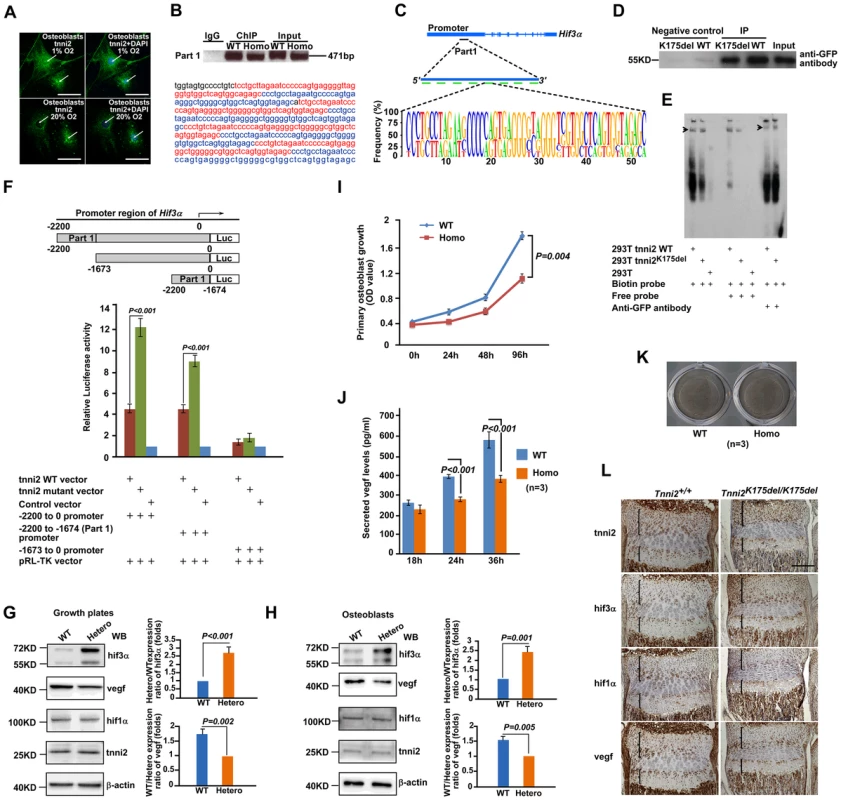Mutant tnni2 protein increased hif3a and reduced vegf expression.