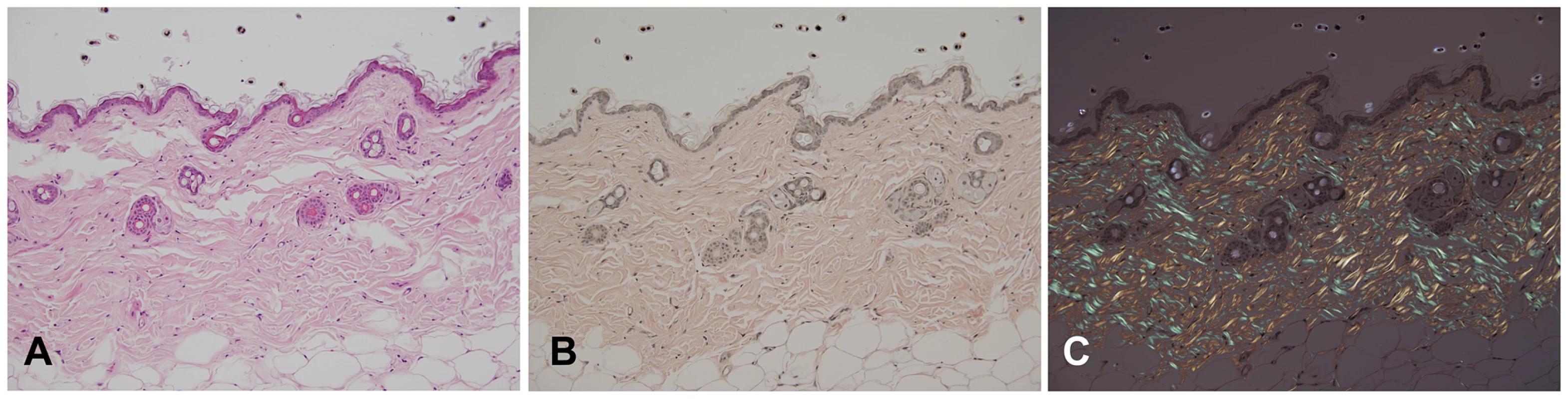 Histopathology analysis of amyloid in skin of an affected mouse.