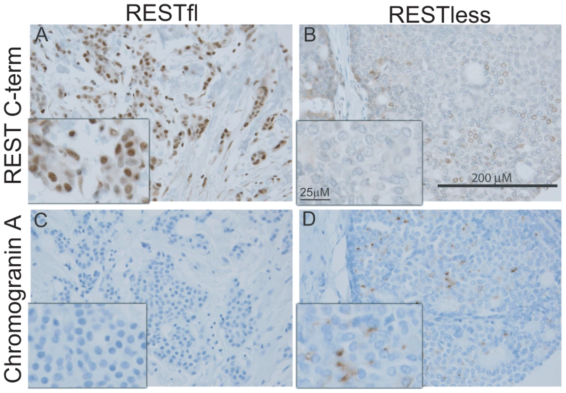 Immunohistochemical screen for functional REST in breast tumors.
