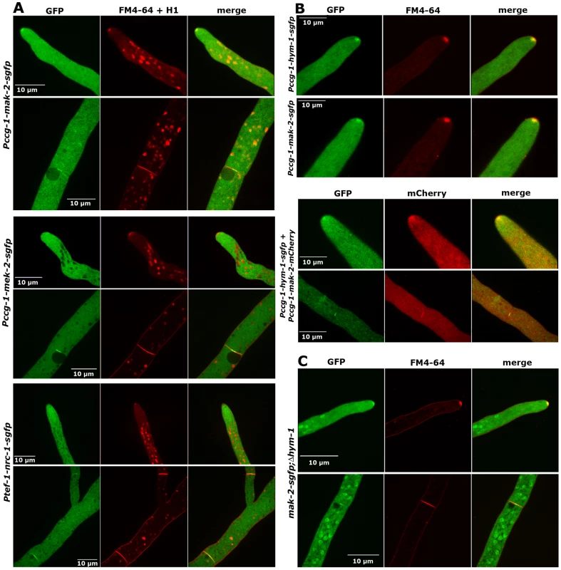 NRC1, MEK2, and MAK2 display different localization patterns in vegetative hyphae.