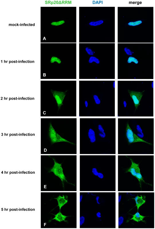 SRp20ΔRRM re-localization from the nucleus to the cytoplasm of SK-N-SH cells during poliovirus infection.
