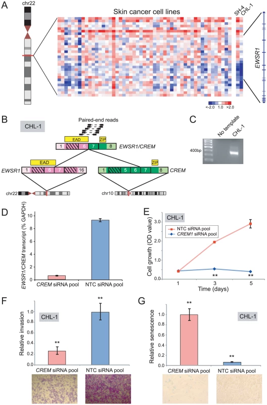 Discovery and characterization of <i>EWSR1/CREM</i> in melanoma.