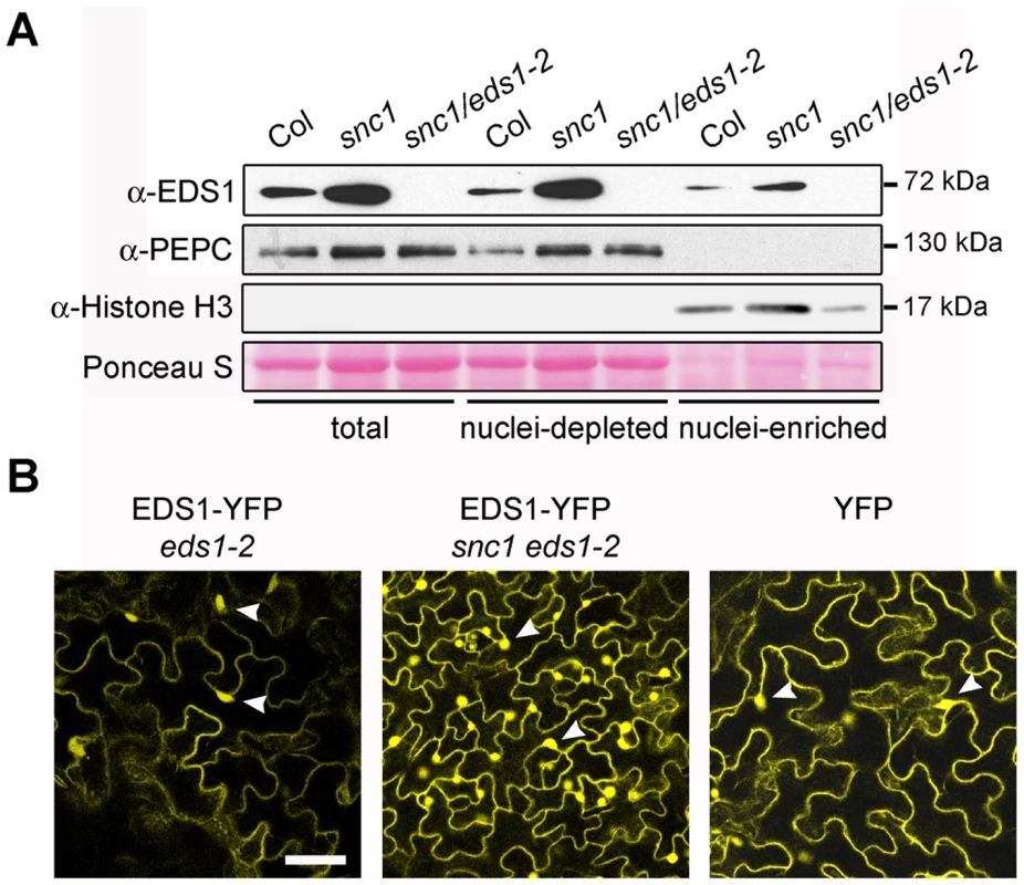 Deregulated resistance in <i>snc1</i> leads to increased accumulation of EDS1 in the nucleus and cytoplasm of <i>Arabidopsis</i> leaves.