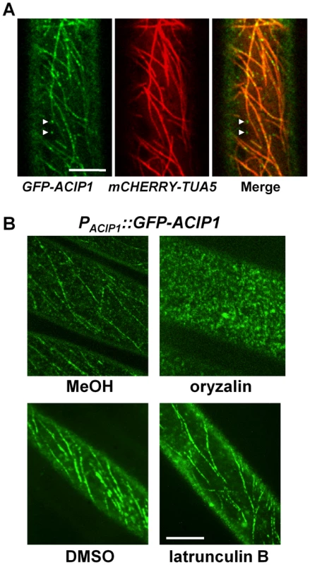 GFP-ACIP1 co-localizes with microtubules.