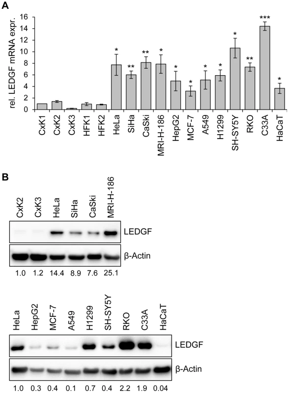 LEDGF expression in primary human keratinocytes and in HPV-positive and HPV-negative cell lines.