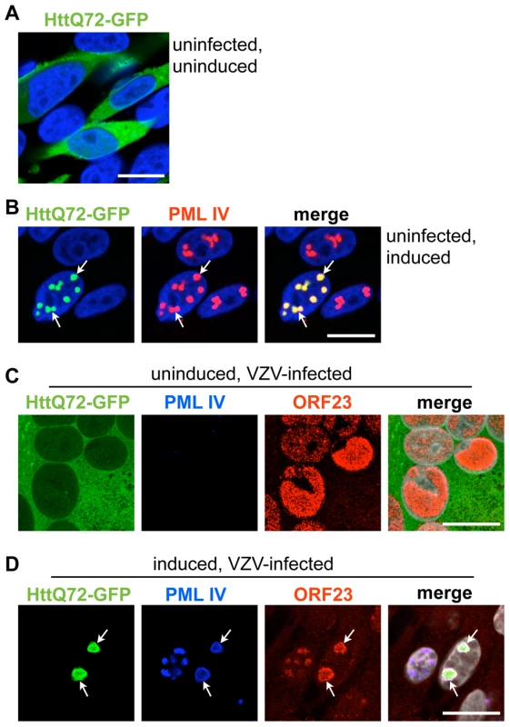 PML IV cages cosequester ORF23 capsid protein and Huntington's disease protein in VZV infected cells.