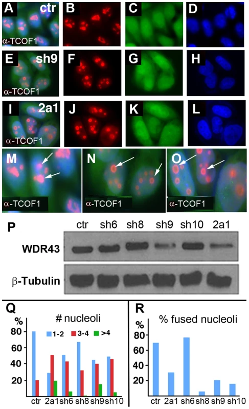 TCOF1 expression in stable <i>WDR43</i> shRNA cell lines.