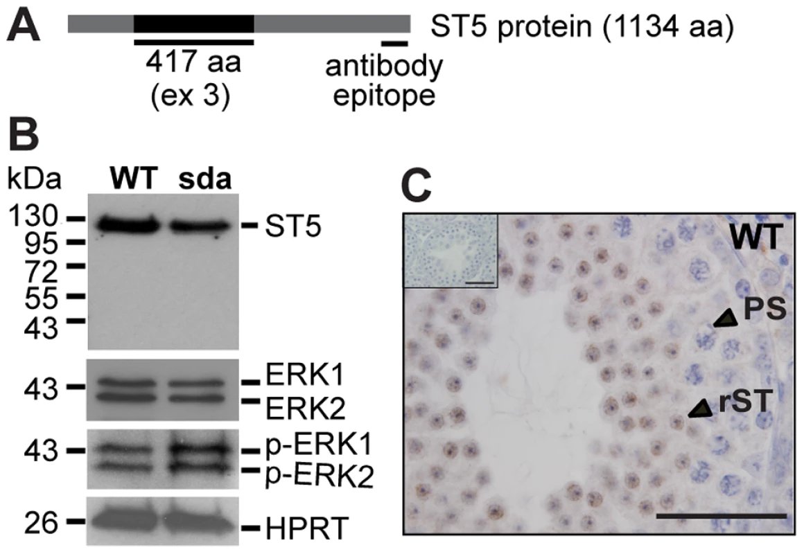 ST5 negatively regulates ERK signalling in round spermatids.