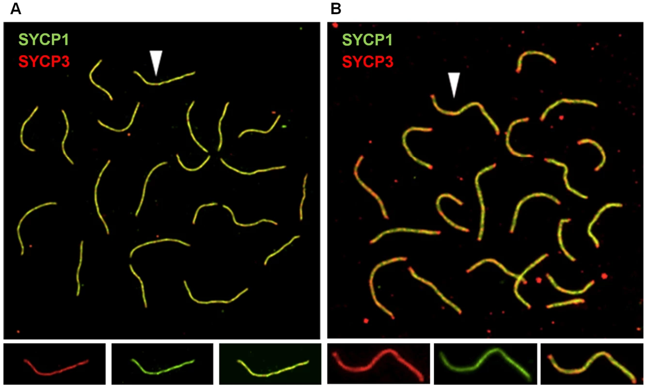 Synaptonemal complex formation is disturbed in cohesin heterozygotes.