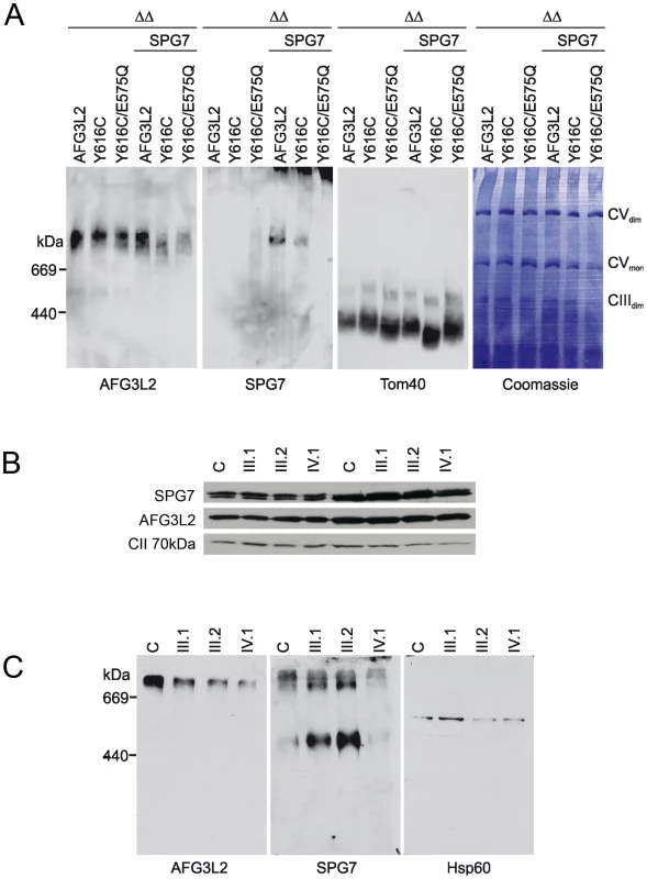 Assembly of AFG3L2, AFG3L2<sup>Y616C</sup>, and AFG3L2<sup>Y616C/E575Q</sup> in mitochondria.