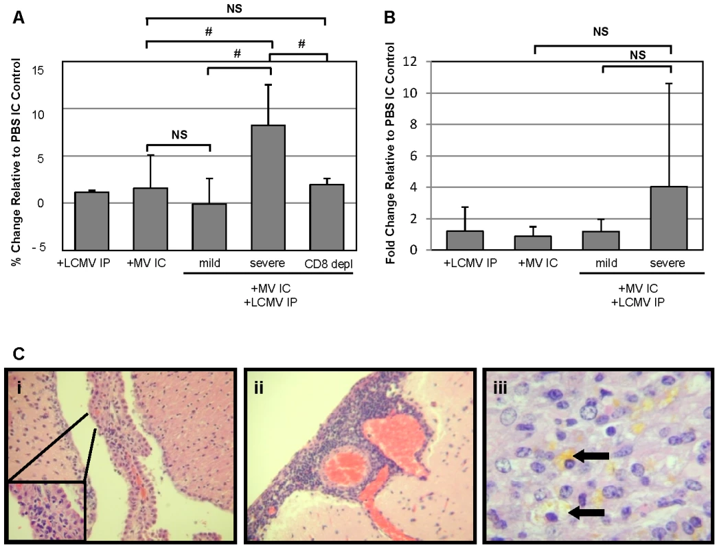 Edema, but not blood brain barrier, changes correlate with pathogenesis in co-infected mice and is dependent on CD8<sup>+</sup> T cells.