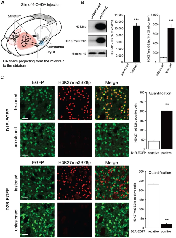 L-DOPA triggers H3K27me3S28 phosphorylation in MSNs of hemiparkinsonian mice.