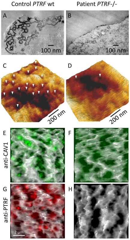 Ultrastructural analysis of caveolae on the fibroblast surface.