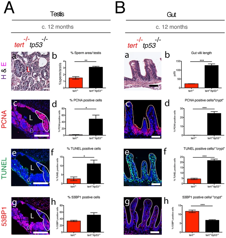 Elimination of <i>tp53</i> function partially rescues <i>tert<sup>−/−</sup></i> degeneration in proliferative tissues.