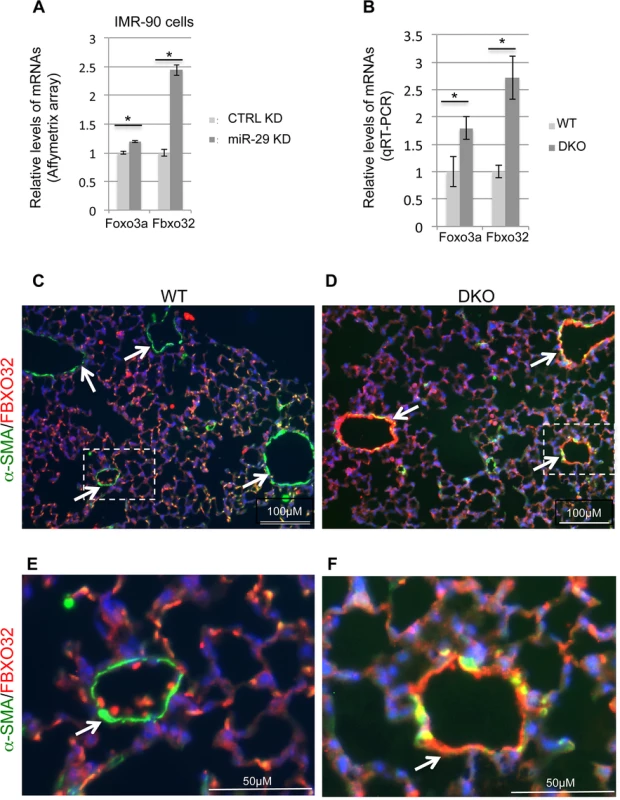 Upregulation of Foxo3a and Fbxo32 in both miR-29 knockdown cells and miR-29 null lungs.