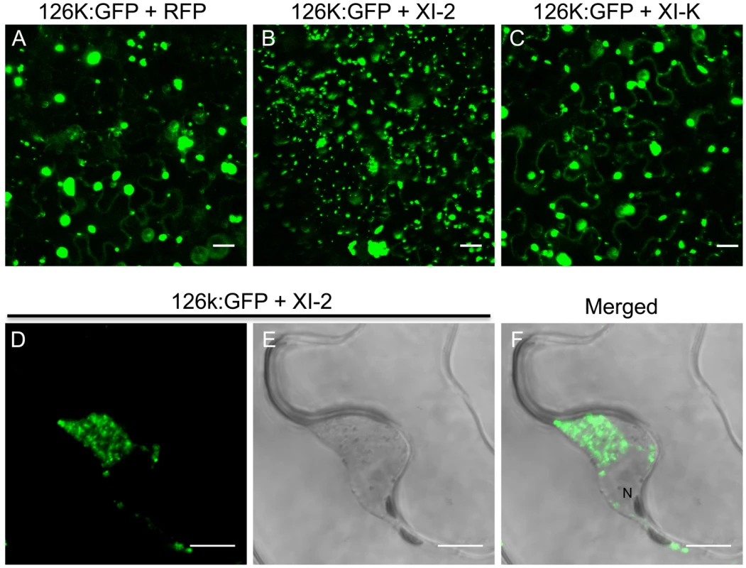 Inhibition of myosin XI-2 disrupts the normal subcellular localization of expressed 126k:GFP.