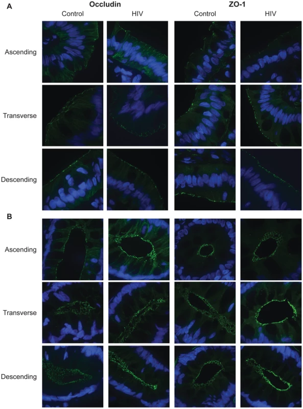 Subcellular localization of tight junctional proteins, occludin and ZO-1, is unaltered in the HIV colon.