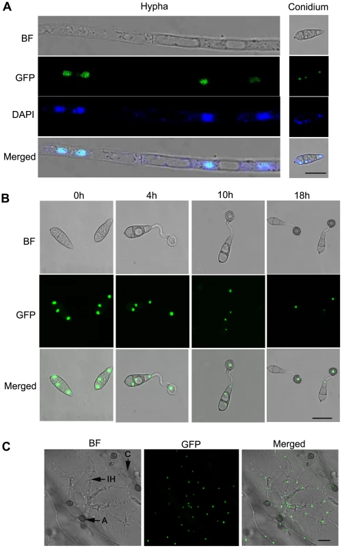 Intracellular localization of MoSom1-green fluorescent protein.