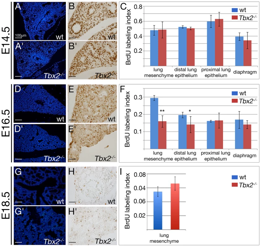 Decreased proliferation and increased apoptosis contribute to hypoplasia of <i>Tbx2</i>-deficient lungs.