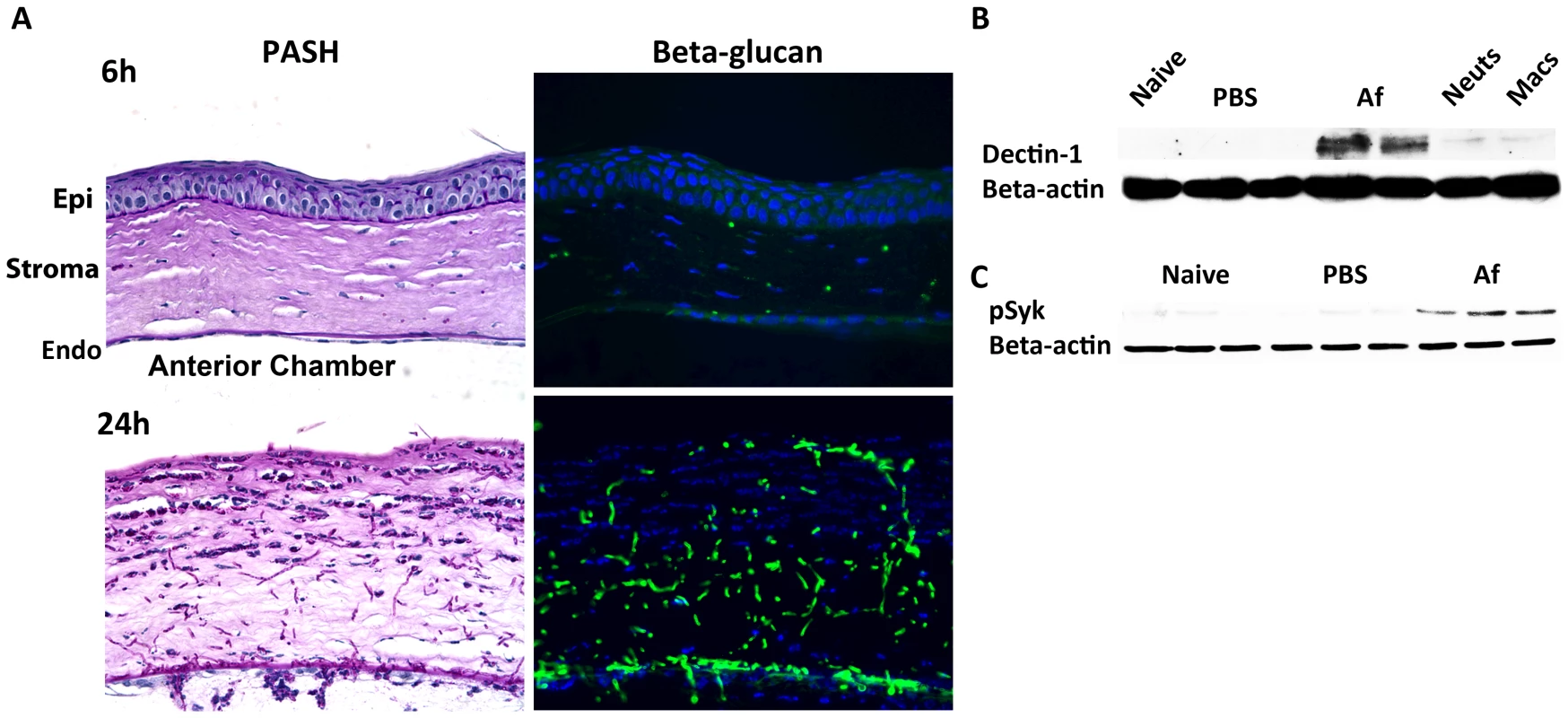 β-glucan expression and Dectin-1 signaling in <i>A. fumigatus</i> keratitis.