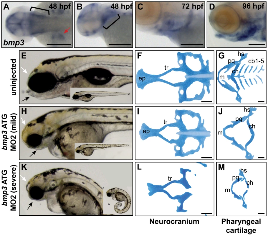 Zebrafish cranioskeletal development requires Bmp3 function.