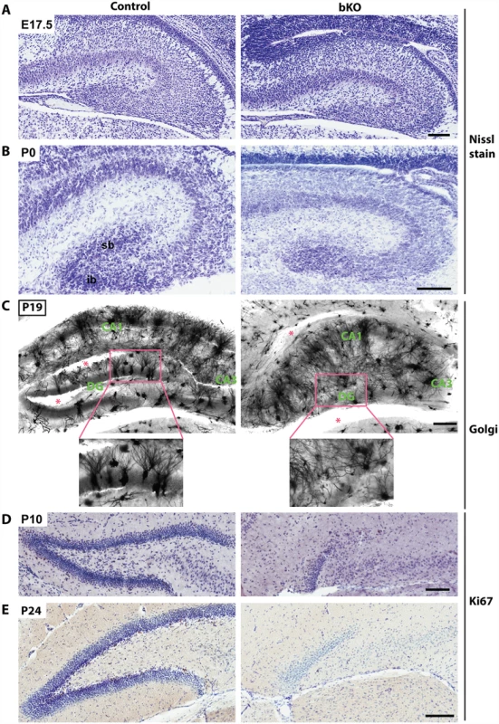 Brpf1 loss impairs dentate gyrus development, dendritic tree formation and neuronal proliferation.