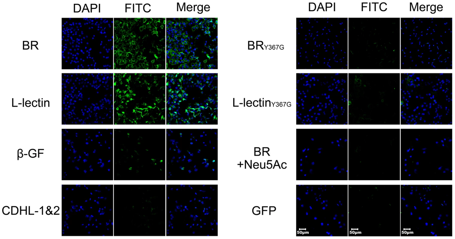 Contribution of the L-lectin module to bacterial adhesion to human lung epithelial cells.