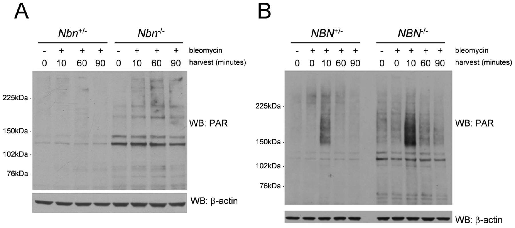 Increased PARP activity in <i>Nbn<sup>−/−</sup></i> murine fibroblasts and NBS patient fibroblasts after DNA damage.