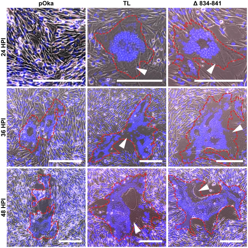Truncation of the gHcyt causes exaggerated syncytia formation in VZV-infected melanoma cells.