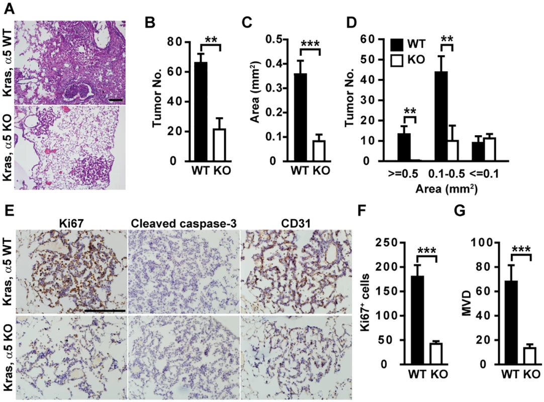Tumor development is delayed in α5(IV)-deficient mice.