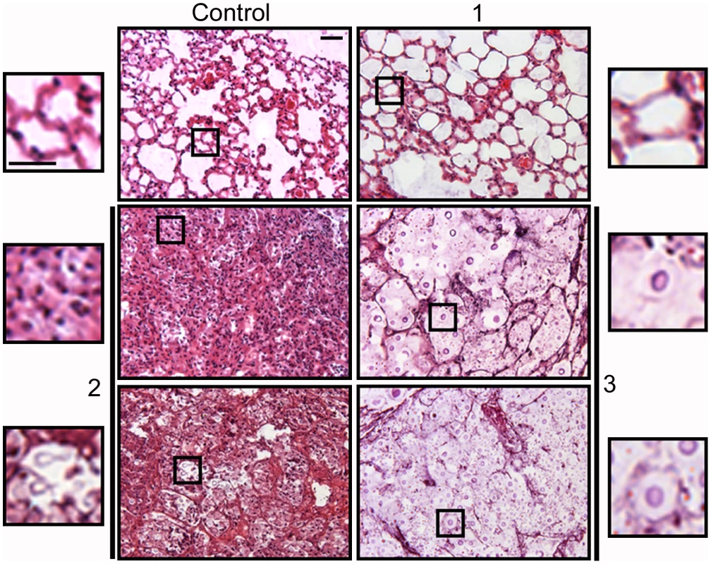Histological sections of mice infected with different <i>C. neoformans inocula</i>.