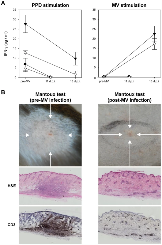 MV infection causes temporary immunological amnesia.