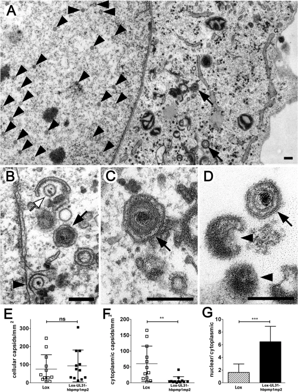 pUL31-hbpmp1mp2 forms mature nucleocapsids delayed in nuclear egress.