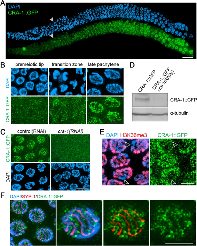Expression and localization of CRA-1::GFP in the <i>C</i>. <i>elegans</i> germline.