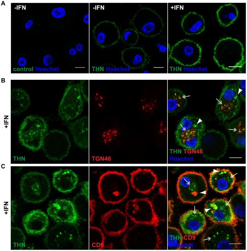 Tetherin localises to the cell surface, TGN, and IPMCs.