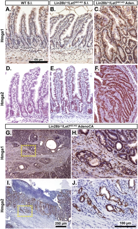 Hmga1 and Hmga2 proteins are increased in invasive areas of adenocarcinomas.