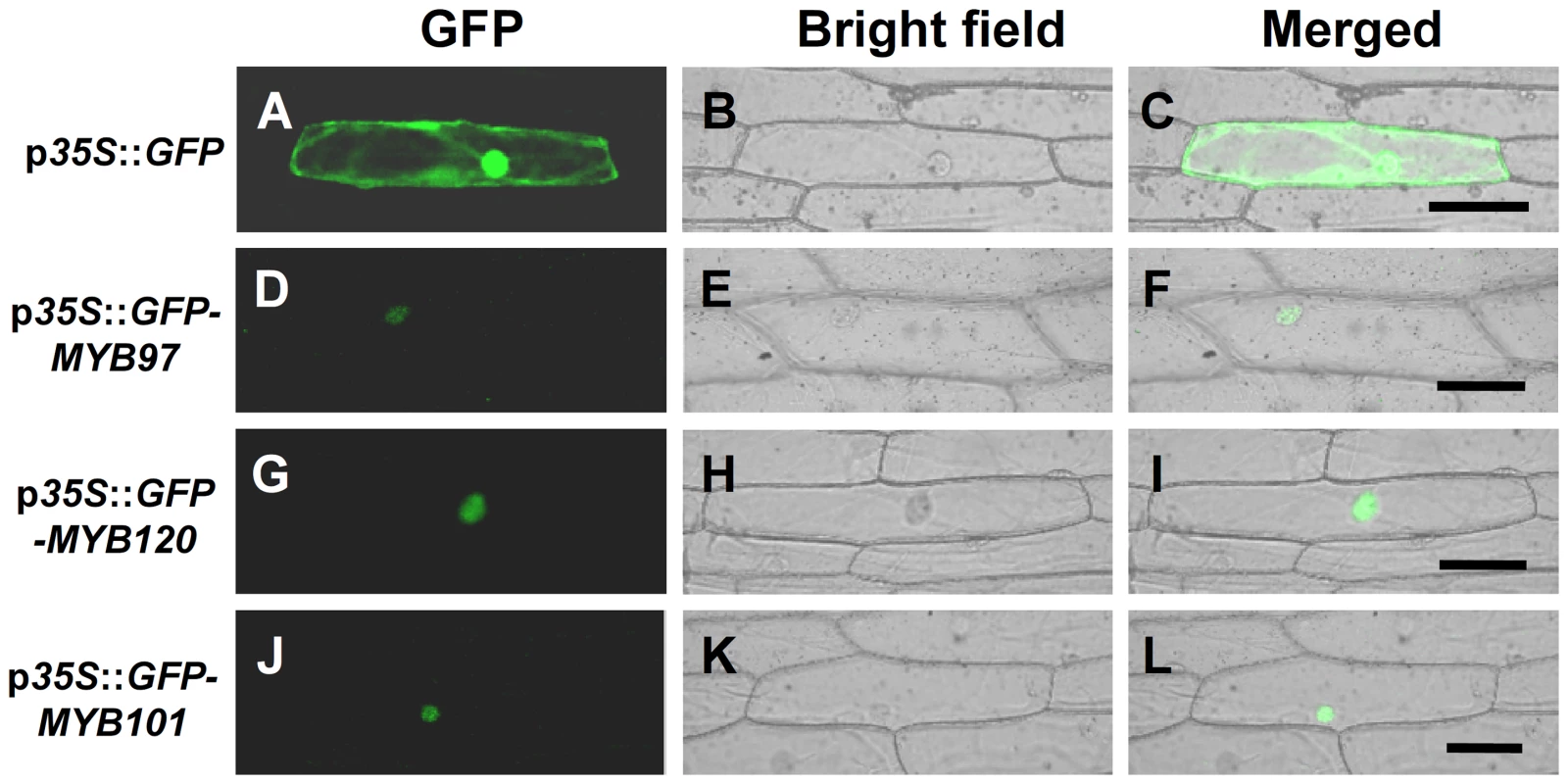 Subcellular localization of GFP-MYB fusion proteins.