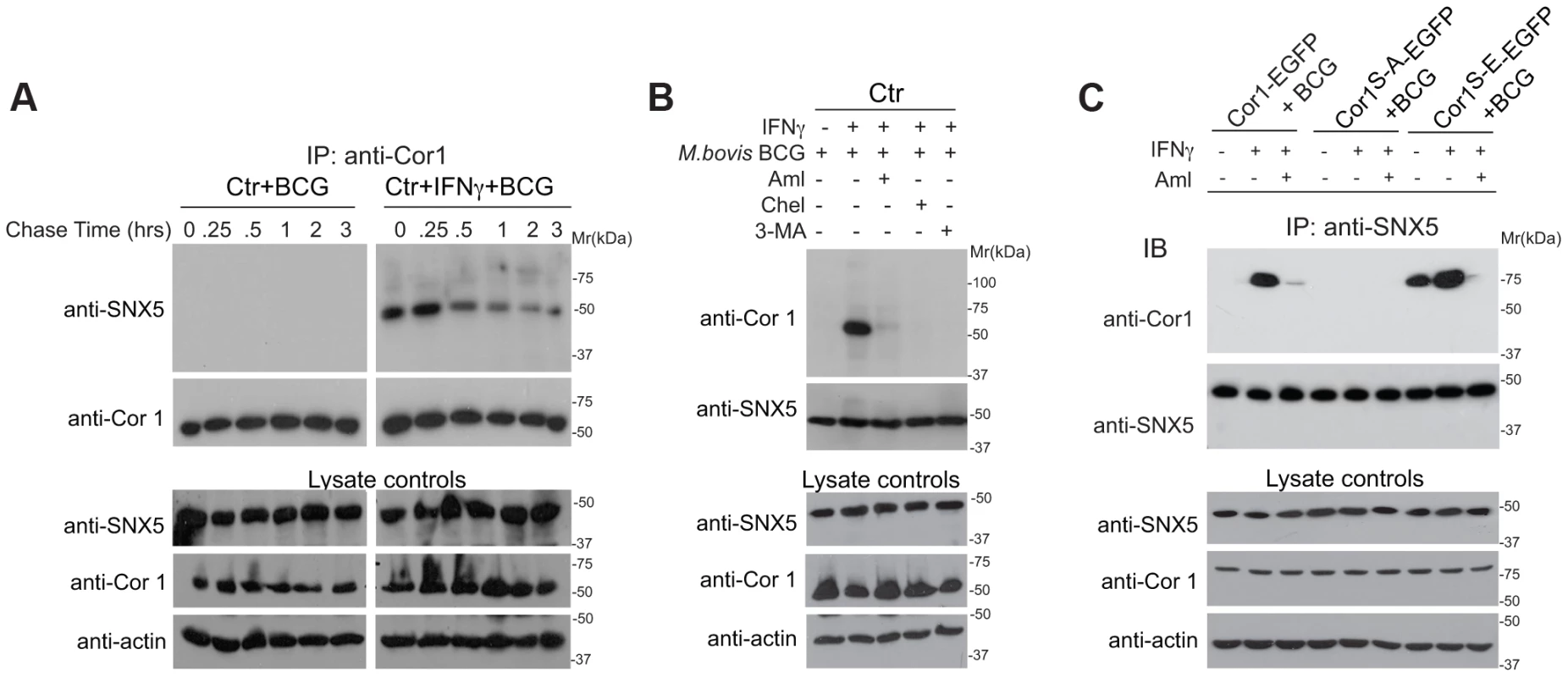 Association of sorting nexin 5 with coronin 1 in IFN-γ activated macrophages.