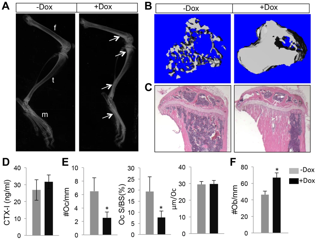 WNT7B enhances bone accrual in postnatal life.