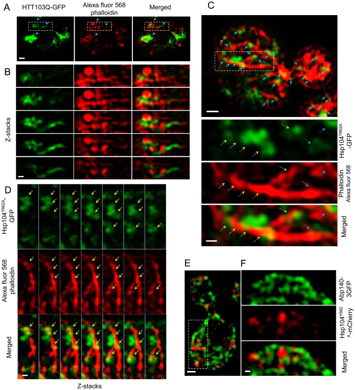 Super-resolution three-dimensional structured illumination microscopy (3D-SIM) revealing association of Htt103Q and Hsp104-linked stress foci with the actin cytoskeleton.