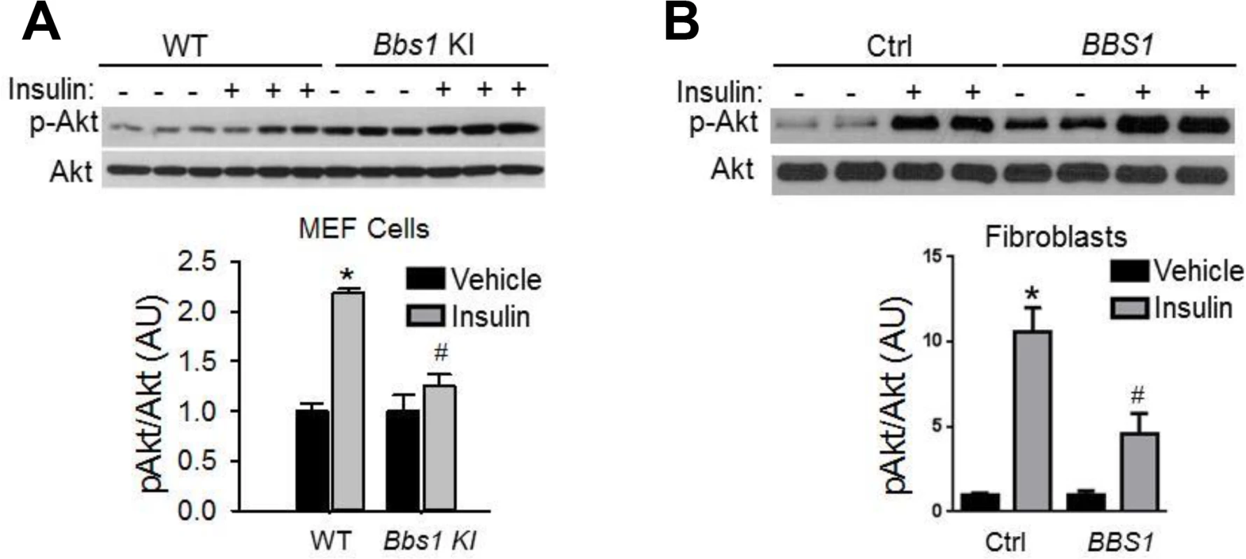 Blunted IR signaling in cells bearing mutant BBS1 protein.