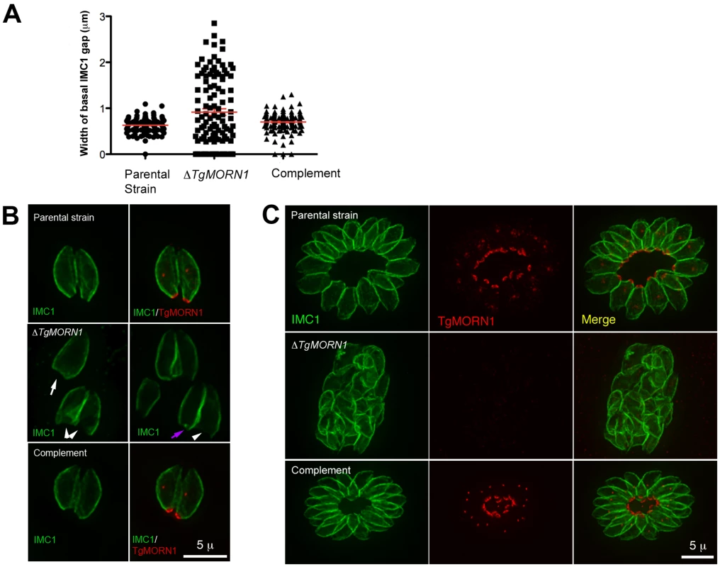 The loss of TgMORN1 affects the organization of the parasite posterior end.