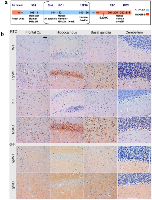 PrP immunoreactivity in the brains of TgMHu2ME199K mice.