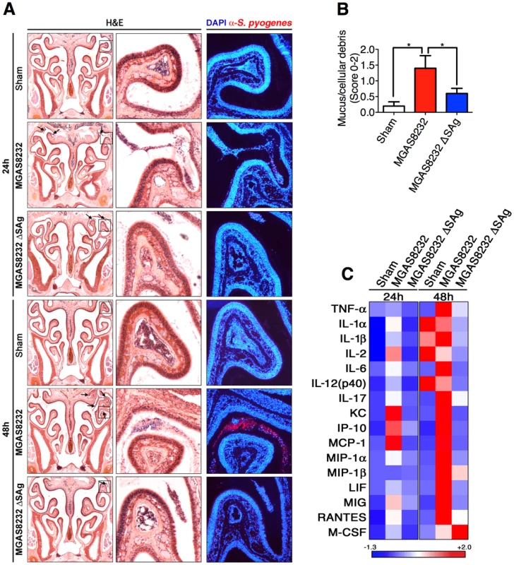 Nasopharyngeal infection of HLA-B6 mice with wild-type <i>S. pyogenes</i> MGAS8232 localizes to the nasal turbinates and induces a SAg-dependent inflammatory response.
