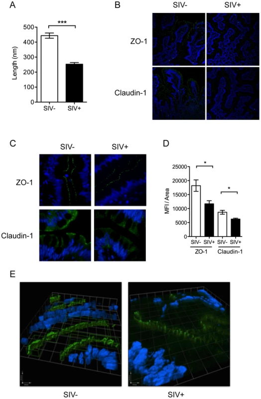 Intestinal epithelial barrier is an early target of SIV infection.