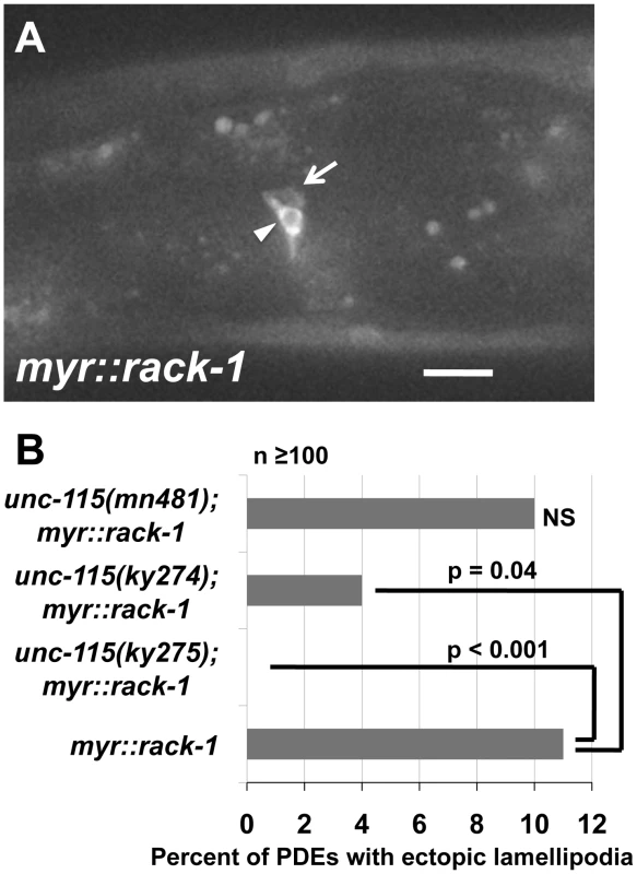 UNC-115 is required for the effects of MYR::RACK-1.