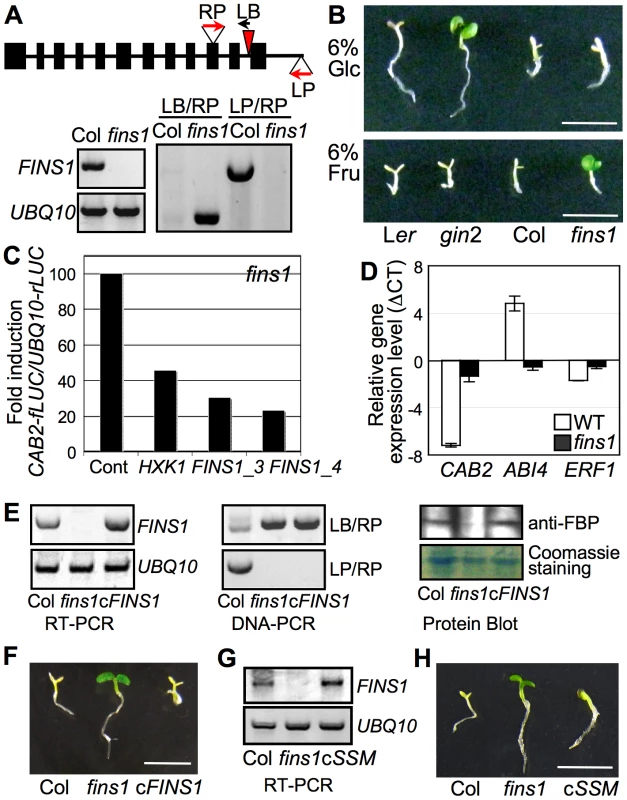 FINS1/FBP in fructose signaling.