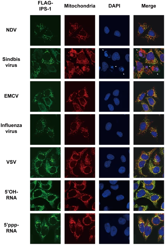 Redistribution of IPS-1 induced by virus-infection and 5′ppp-RNA-transfection.