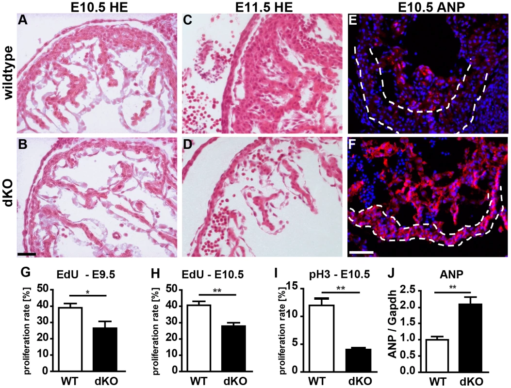Loss of <i>miR-1/133a</i> leads to aberrant heart development and causes embryonic lethality.