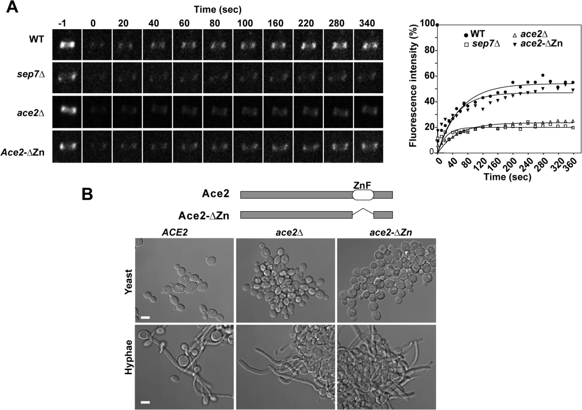 Ace2 controls septin ring dynamics during hyphal development.